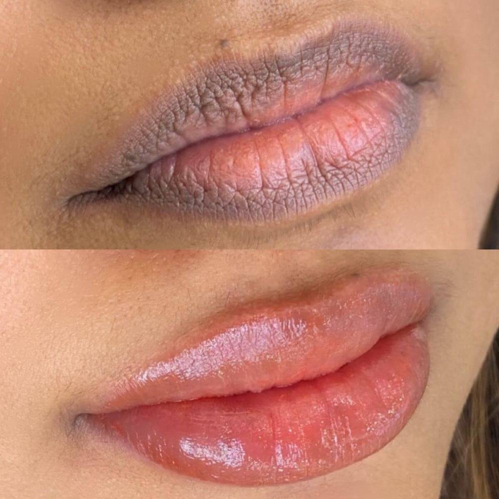 Antes y después de micropigmentación de labios: tono apagado y desigual convertido en un rosado uniforme y luminoso