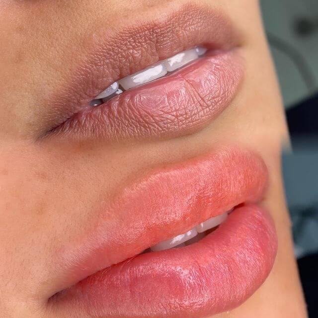Antes y después de micropigmentación de labios con contorno definido y tono unificado